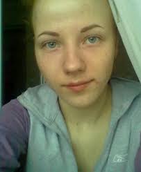 Otvety Mail Ru U Menya Nekrasivaya Vneshnost Nos Kartoshkoj Guby Tonkie Rot Bolshoj I Shirokij Lob Chto Mne Delat