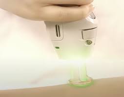 The intense heat of the laser damages the hair follicle, which inhibits future hair growth. Laser Hair Removal Knox Laser Skin Solutions