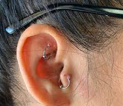 Piercing Bump 6 Ways To Get Rid Of Cartilage Or Nose Keloid Blister