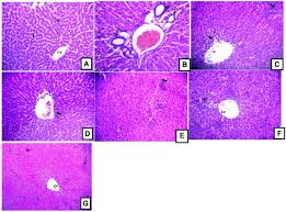 Image result for Lannea humilis