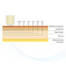 skinpen micro needling rejuvenate skin concierge