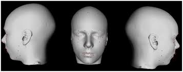 Automated Analysis of Craniofacial Morphology Using Magnetic Resonance  Images
