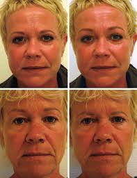 Image of the entire face of our fourth model. (Above, left) High...