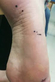 Image result for brown patches on the feet