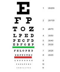 Kacamata hanya butuh ganti lensa kalau misalkan resepnya berubah. Penyebab Mata Plus Dan Cara Mengatasi Mata Plus