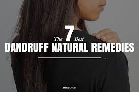 It not only helps to moisturize your dry scalp but it also curbs the urge to itch and offers instant relief. 7 Best Natural Remedies For Dandruff And Itchy Scalp Yuri Elkaim