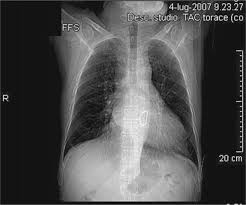 X Ray Anatomy Of The Heart Springerlink Roger seheult, md clinical and exam preparation. x ray anatomy of the heart springerlink