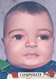 21 years ago today, Jamie Doe, the first of three unidentified infants  found in Goodhue County, Minnesota. Jamie is maternally related to a male  infant who was discovered in 2003. A third