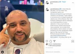 He is an actor, known for sítio do picapau amarelo (2001), o profeta (2006) and os mutantes (2008). Geraldo Luis Apos Cirurgia Aparece Careca E Visual E Exposto Veja