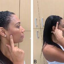 A) Palpation testing of the masseter muscle. The masseter muscle can...