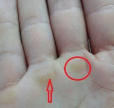 In the following article, we shall be looking at the. What Is The English Name For The Palm S Spots Of The Working Hands English Language Learners Stack Exchange