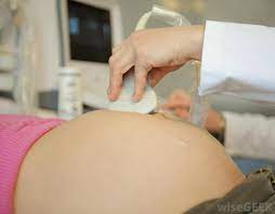 Mirror syndrome, also known as ballantyne syndrome and maternal hydrops, is a condition that affects pregnant women. What Is Mirror Syndrome With Pictures