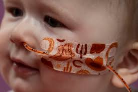 First pediatric partial heart transplant performed at Dell Children's