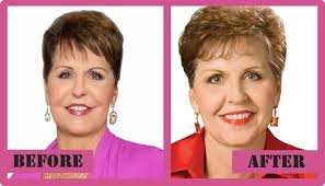 Joyce meyer (born june 4, 1943) is famous for being novelist. Joyce Meyer Plastic Surgery Personal Fall Of A Religious Woman