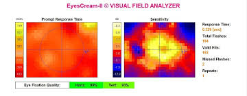 Free Visual Field Test Of Your Eyes For Pc