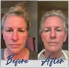 Glow RX has completely transformed my skin. I went from liking my bare face  to loving my bare face and going most days without makeup. Here's what  you'll get in your customized