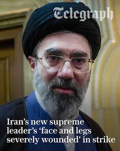 Iran's new supreme leader reportedly suffered a disfiguring facial injury  in the air strike that killed his father at the start of the war But is he  still involved in decision making