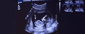 32 Old Wives Tales For Baby Gender Prediction My Baby S Heartbeat Bear