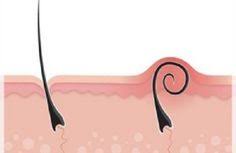 pin auf dicas de beleza