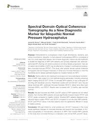 pdf spectral domain optical coherence tomography as a new