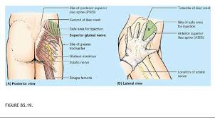 Image result for Lower Cervical Intramuscular Injection