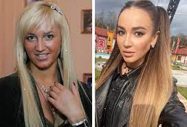 Сегодня это утонченная, элегантная особа. Polnostyu Perekroili Lico Zvezdy Chya Vneshnost Izmenilas Do Neuznavaemosti Ya Pokupayu
