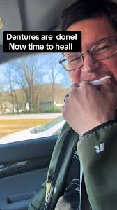 Young Men with Dentures