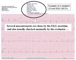 Eheart Introduction To Ecg Ekg