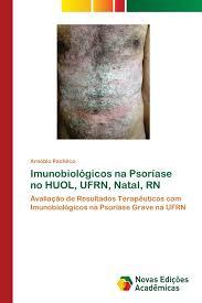 Psoríase é uma doença inflamatória da. Imunobiologicos Na Psoriase No Huol Ufrn Natal Rn Avaliacao De Resultados Terapeuticos Com Imunobiologicos Na Psoriase Grave Na Ufrn Amazon De Pacheco Arnobio Fremdsprachige Bucher
