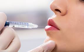 Image result for Dermal Filler Injection