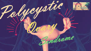 Upaya yang harus dilakukan agar tidak terkena gangguan penyakit pada sistem reproduksi manusia. Penyakit Pada Sistem Reproduksi Manusia Dan Cara Pencegahannya Youtube