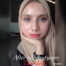 I installed it on top of a vintage cabinet to. Vsl Beauty Care Terengganu Startseite Facebook