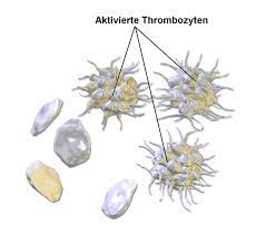 Having more than 450,000 platelets is a condition called thrombocytosis; Thrombozyt Wikipedia