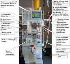 Fresenius 2008t dialysis machine diagram / 2008t bluestar hemodialysis machine ; How To String A Hemodialysis Machine Instructables