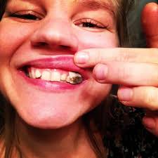 | snus und die schweiz das der verkauf von snus in der schweiz überhaupt verboten war, geht auf einen parlamentarischen. Oraltabak Snuser Wacht Auf Doccheck