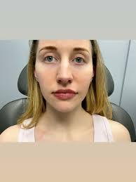 Zhanna Fagin, APRN-BC