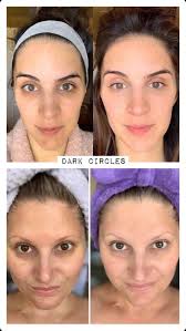 Our First Rejuvenating Set Has Arrived