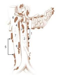 Seer Training Abdominal Lymph Nodes Lymph Nodes Abdominal Lymph System
