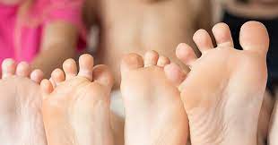 Fusspilz Bei Kindern Wie Behandeln Emcur