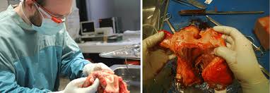 Connecticut beats the national average by 6.3%, and massachusetts furthers that trend with another $11,430 (8.0%) above the $143,261. The Forensic Pathologist Is Taking A Picture Of The Heart Using Google Download Scientific Diagram