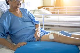 Pcl injuries are often due to a blow to the knee while it is bent, including striking the knee against the dashboard during an automobile accident or when falling onto a grade ii: Knee Surgery Rehabilitation Timeline And What To Expect