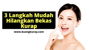 Petua hilangkan gegata yang anda kongsikan mungkin sangat berguna kepada pembaca lain. Pengalaman Sebenar Cara Hilangkan Kurap Di Celah Peha Punggung