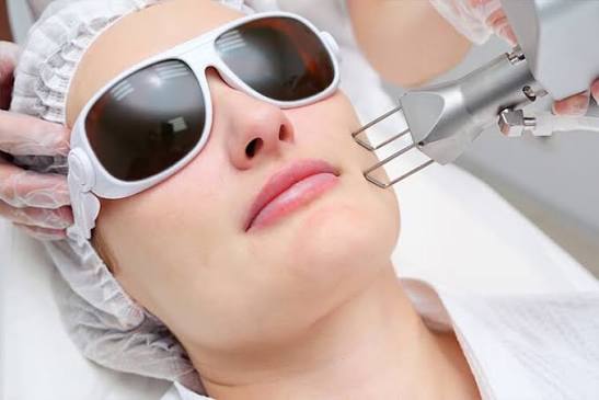 A package of 3 fractional CO2 laser sessions from Swan Specialized Clinic  in Riyadh