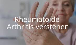 Diagnose Der Rheumatoiden Arthritis Selpers