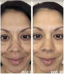 Kathy Covers Experiance With Collagen Elixir