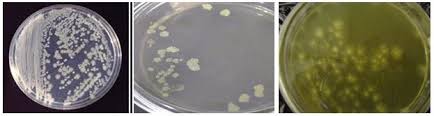 Previous scientific opinion of the biohaz panel. Colonies Of Listeria Monocytogenes On Listeria Selective Agar Lsa Download Scientific Diagram