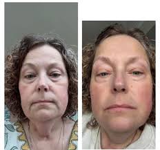 Introduction to Neora Wellness and Skincare in Foley, AL