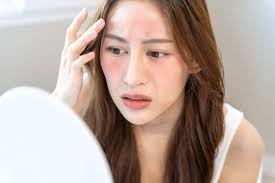 Chăm sóc da nhạy cảm: Liệu có khó như bạn nghĩ? • Hello Bacsi