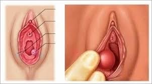 Ciri fisik bambu ini bisa dilihat dari warna batangnya yang hijau, ditutupi dengan rambut cokelat keputihan dana akan berubah menjadi hujau kecokelatan saat terjadi kekeringan. Dokter Klo Vagina Dari Dalam Nampak Seperti Daging Lemak Putih Putih Dan Mau Mendekati Vagina Saat Hamil Dan Keluar Keputihan Itu Tandanya Apa Yaa Terima Kasih Dokter Honestdocs