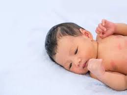 Types of lung cancer in children and their related symptoms. Coronavirus Symptoms In Newborns Can Newborns Catch Covid 19 What Symptoms Should You Lookout For